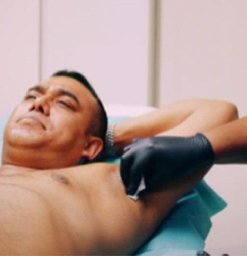 armpit-treatment