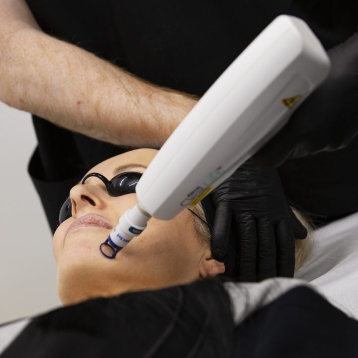 ClearLift Laser by Alma Lasers