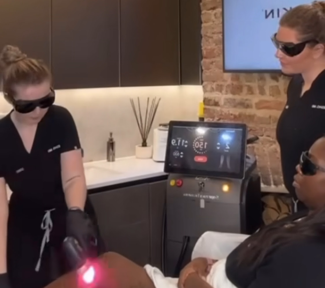 Laser Hair Removal with the Alma Soprano Titanium